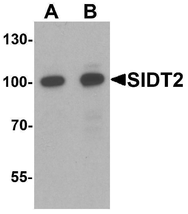 a09551 sidt2 primary antibodies wb testing 1
