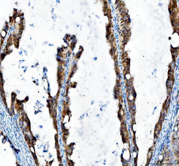IHC analysis of MST4/STK26 using anti-MST4/STK26 antibody (A09552-2)
