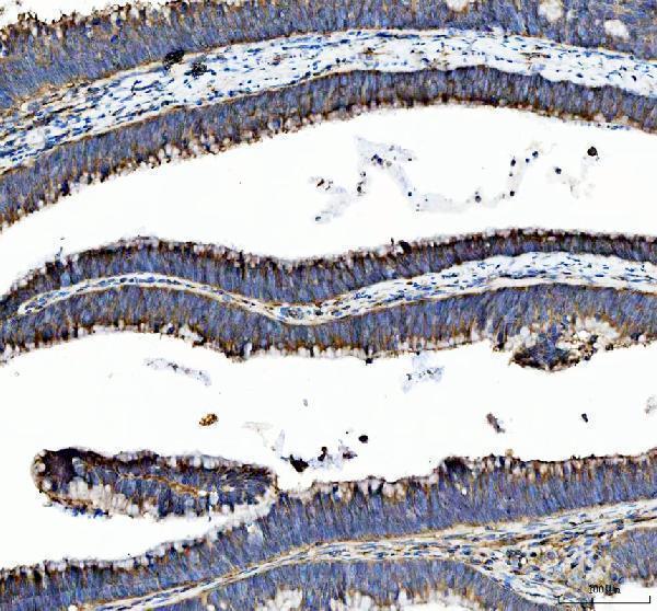 IHC analysis of MST4/STK26 using anti-MST4/STK26 antibody (A09552-2)