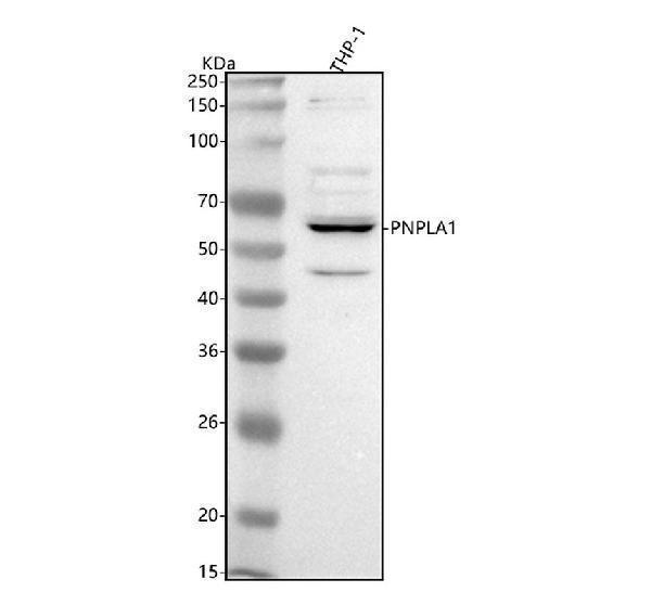  Western blot analysis of PNPLA1 using anti-PNPLA1 antibody (A09557-1)