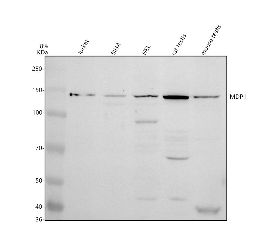 Western blot analysis of MDP1 using anti-MDP1 antibody (A09562-1)