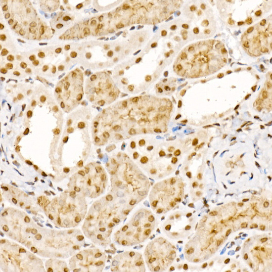 Immunohistochemistry of paraffin-embedded mouse kidney using UBASH3B Rabbit pAb  at dilution of 1:200 