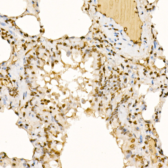 a09570 1 ubash3b primary antiboties ihc testing 4