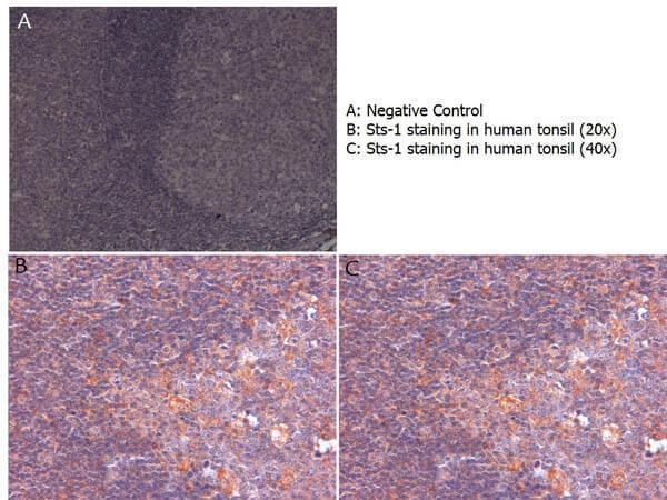 a09570 ubash3b primary antibodies ihc testing 1