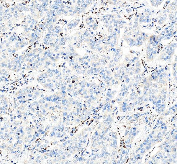 IHC analysis of COX6A1 using anti-COX6A1 antibody (A09572-1)