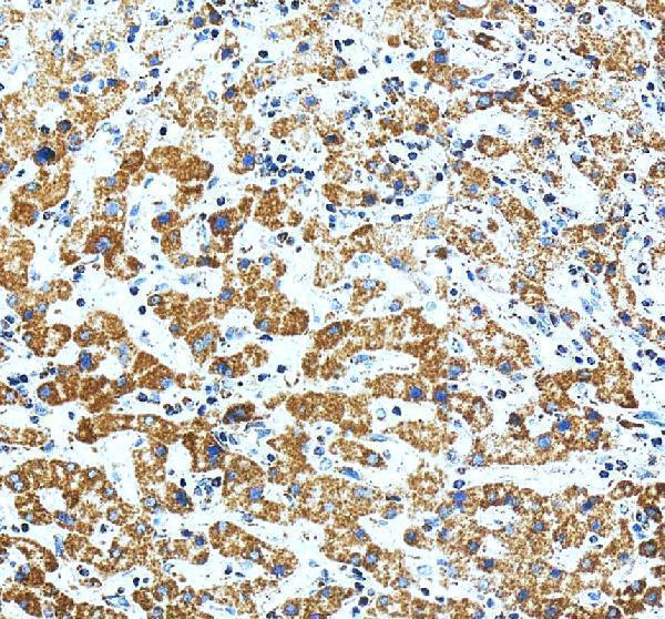 IHC analysis of COX6A1 using anti-COX6A1 antibody (A09572-1)