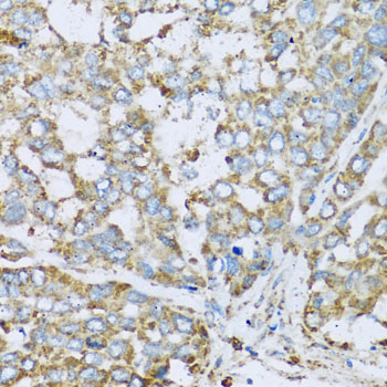 Immunohistochemistry of paraffin-embedded rat cerebellum using COX6A1 antibody  at dilution of 1:100 