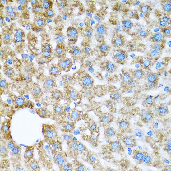 a09572 cox6a1 primary antiboties ihc testing 4