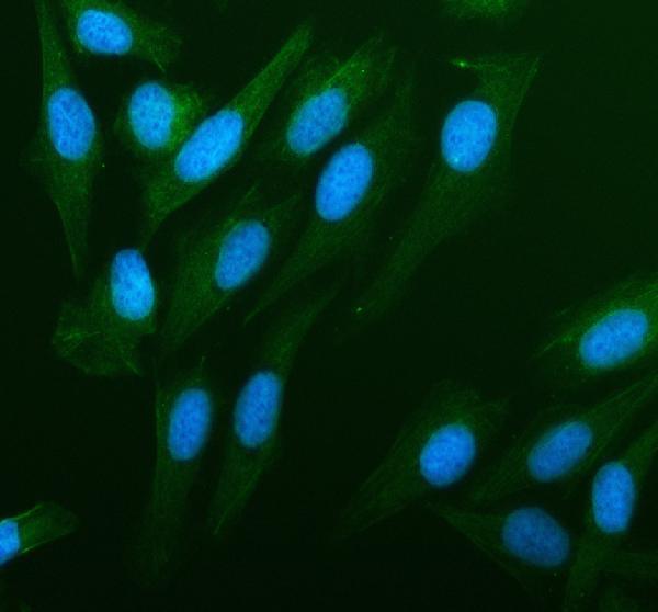 a09573 2 pdlim4 primary antibodies if testing 2