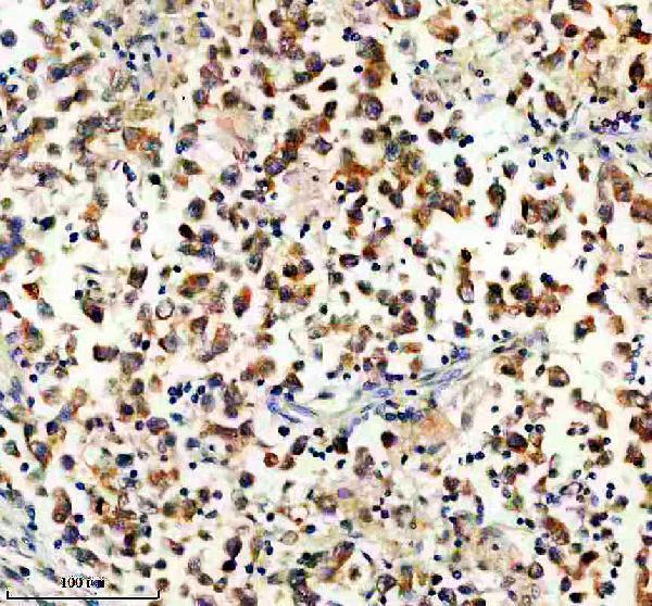 a09574 1 eif2s3 primary antibodies ihc testing 1