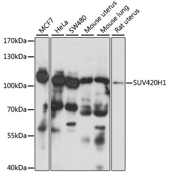 Western blot analysis of extracts of various cell lines, using SUV420H1 antibody  at 1:1000 dilution