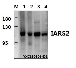 Western blot (WB) analysis of IARS2 polyclonal antibody at 1:500 dillution
Lane1:HCT-116 whole cell lysate(40μg)
Lane2:DLD whole cell lysate(40μg)
Lane3: HEK293T whole cell lysate(40μg)
Lane4:The Lung tissue lysate of Mouse(40μg)