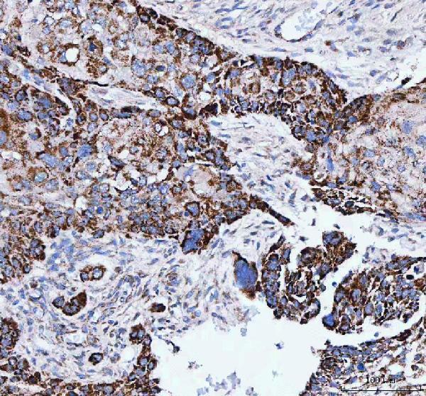  IHC analysis of IARS2 using anti-IARS2 antibody (A09580-2)