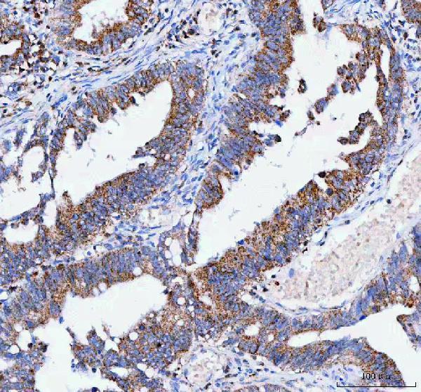 a09580 2 iars2 primary antibodies ihc testing 4