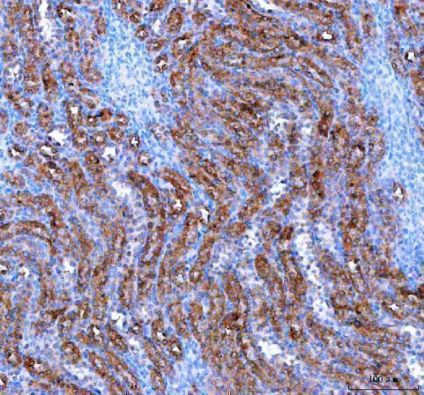 a09580 2 iars2 primary antibodies ihc testing 6