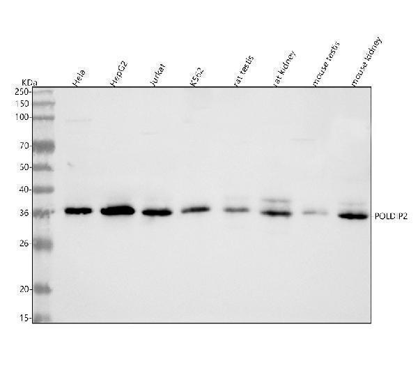  Western blot analysis of POLDIP2 using anti-POLDIP2 antibody (A09581-4)