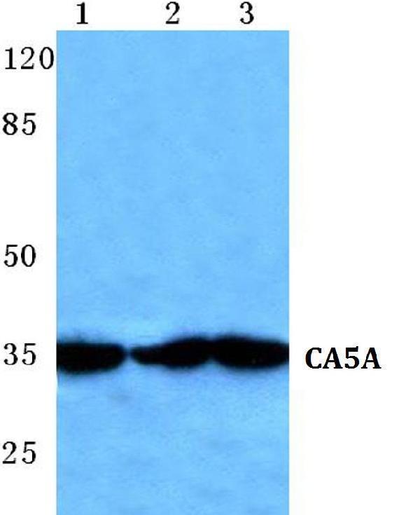 a09582 1 ca5a primary antiboties wb testing 1