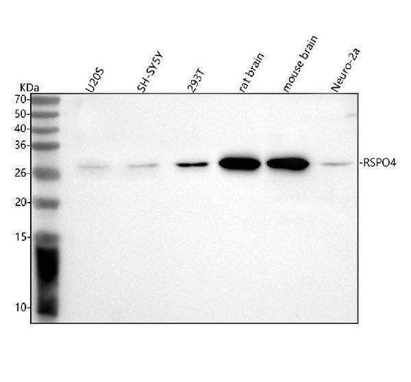  Western blot analysis of RSPO4 using anti-RSPO4 antibody (A09583)