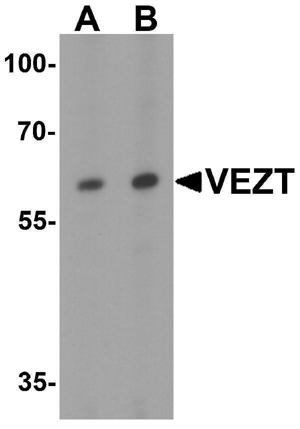 Western blot analysis of VEZT in 293 cell lysate with VEZT antibody at (A) 1 and (B) 2 μg/ml