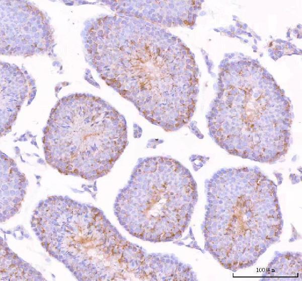 IHC analysis of STK31 using anti-STK31 antibody (A09588-2)