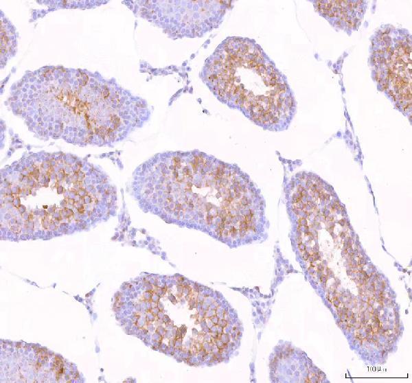 a09588 2 stk31 primary antibodies ihc testing 2