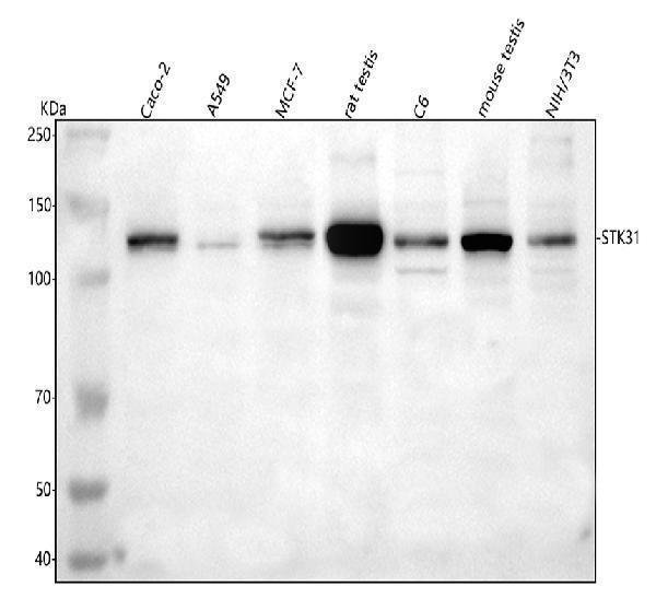  Western blot analysis of STK31 using anti-STK31 antibody (A09588-2)