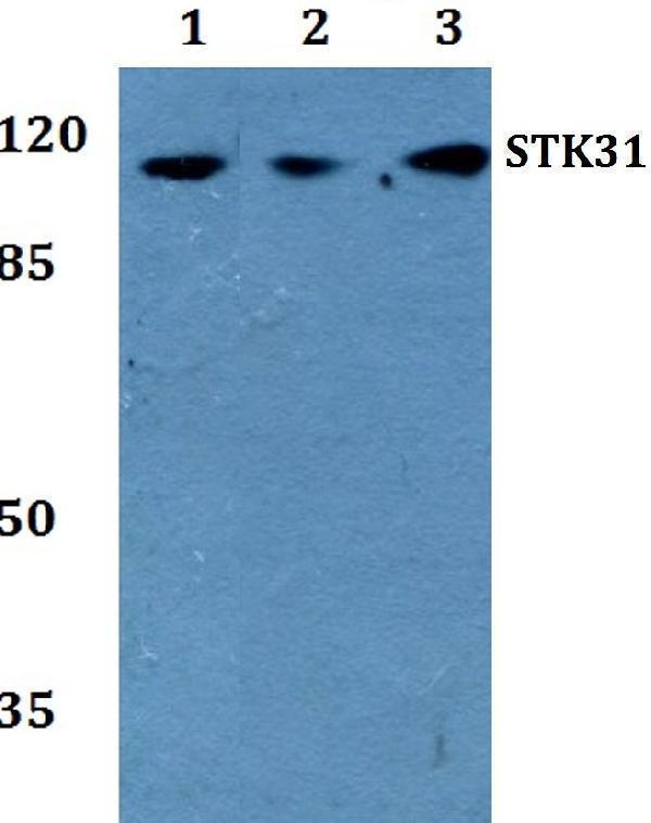 a09588 stk31 primary antiboties wb testing 1