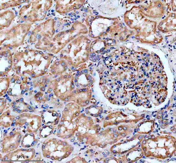 IHC analysis of SLC25A31 using anti-SLC25A31 antibody (A09597-2)
