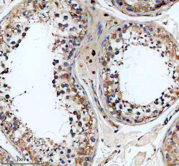 IHC analysis of SLC25A31 using anti-SLC25A31 antibody (A09597-2)