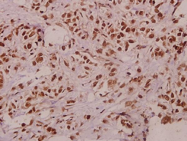 a09601 tceal1 primary antiboties ihc testing 2