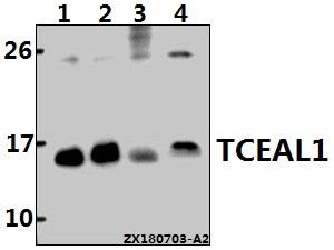 a09601 tceal1 primary antiboties wb testing 1