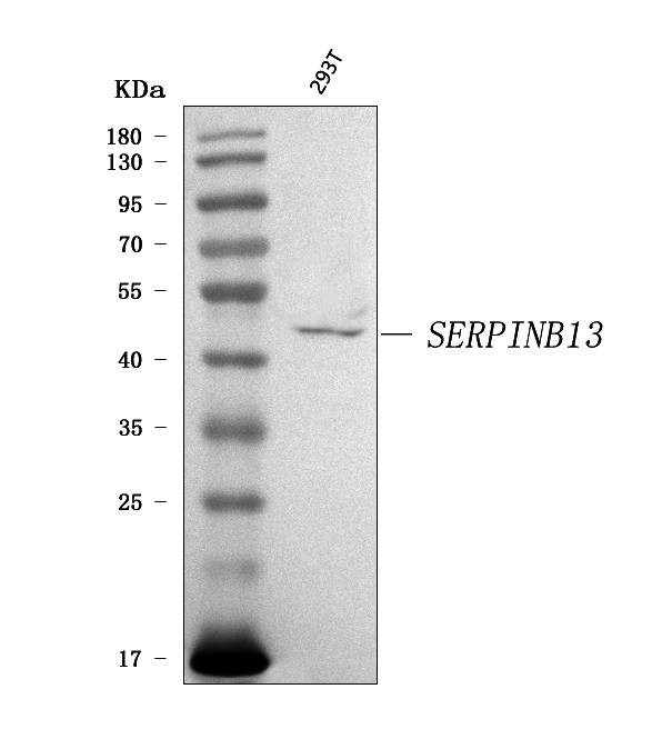  Western blot analysis of SERPINB13 using anti-SERPINB13 antibody (A09602-1)