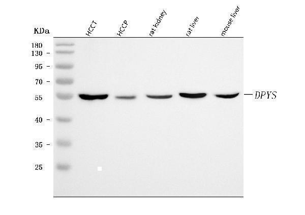  Western blot analysis of DPYS using anti-DPYS antibody (A09603-1)