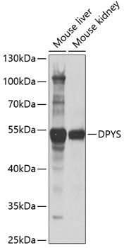 Western blot analysis of extracts of various cell lines, using DPYS antibody  at 1:1000 dilution