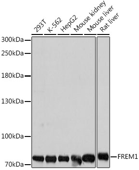 a09605 1 frem1 primary antiboties wb testing 1