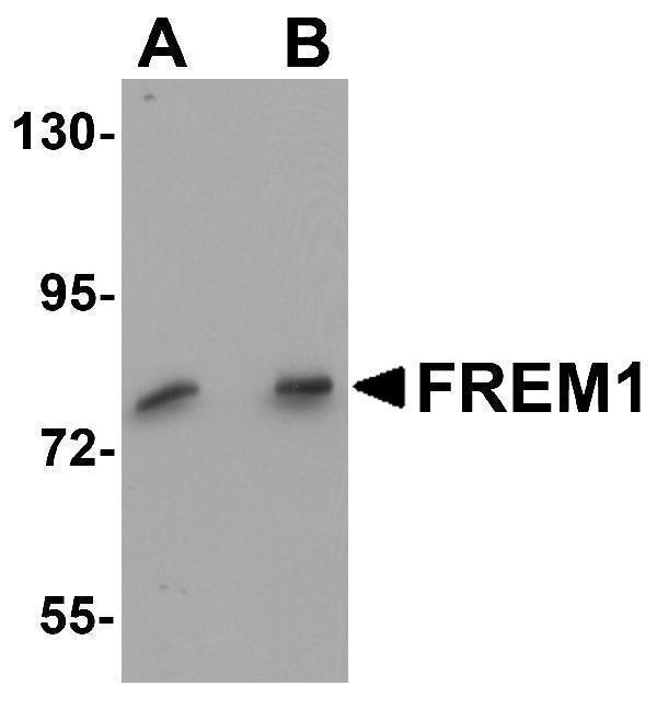 a09605 frem1 primary antibodies wb testing 1