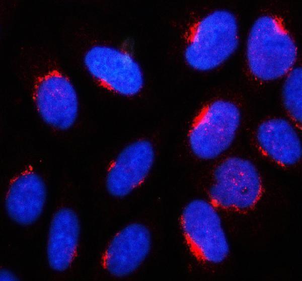 a09609 1 galnt11 primary antibodies if testing 1