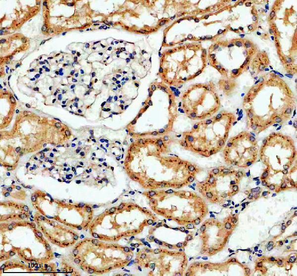 a09609 1 galnt11 primary antibodies ihc testing 1