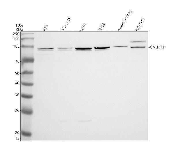 a09609 1 galnt11 primary antibodies wb testing 1