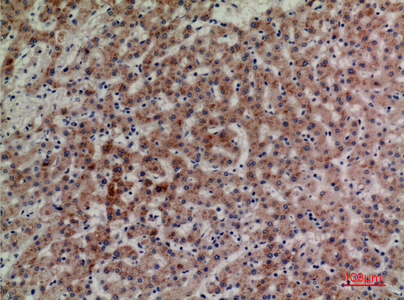 a09611 lilra4 primary antibodies ihc testing 1