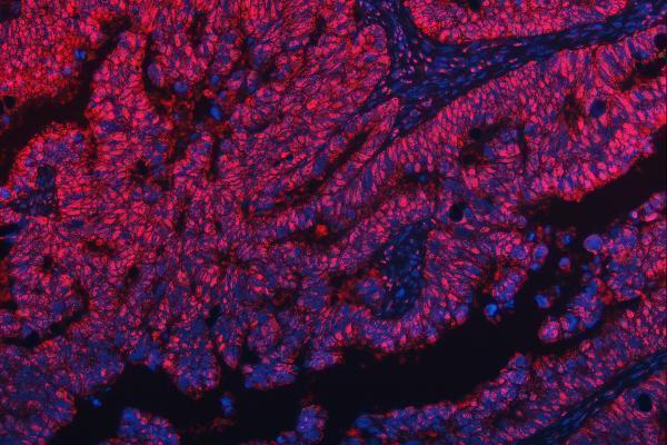 a09612 1 trmt10c primary antibodies if testing 10