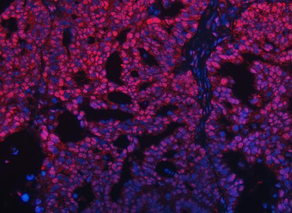 a09612 1 trmt10c primary antibodies if testing 11