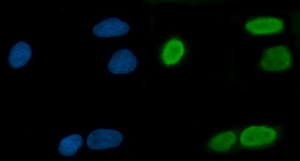 a09612 1 trmt10c primary antibodies if testing 9