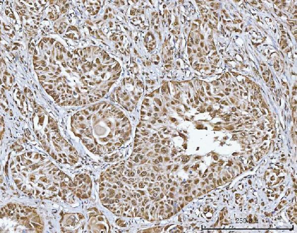 a09612 1 trmt10c primary antibodies ihc testing 2