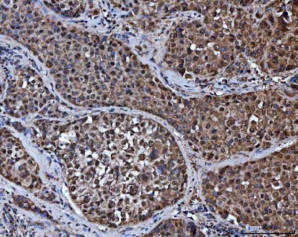 a09612 1 trmt10c primary antibodies ihc testing 3