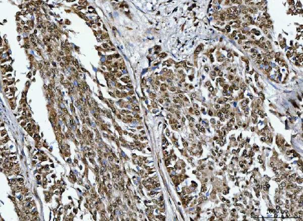a09612 1 trmt10c primary antibodies ihc testing 4