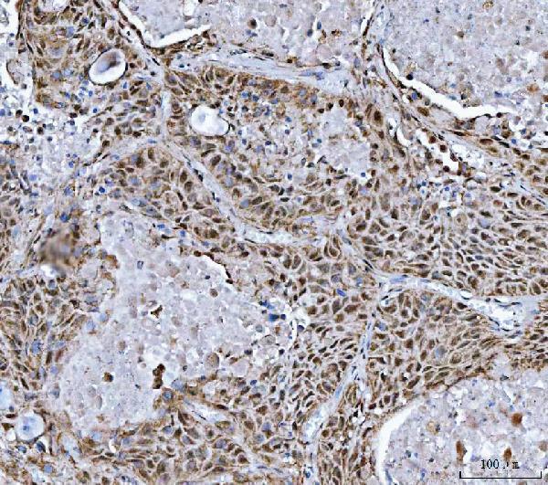 a09612 1 trmt10c primary antibodies ihc testing 5