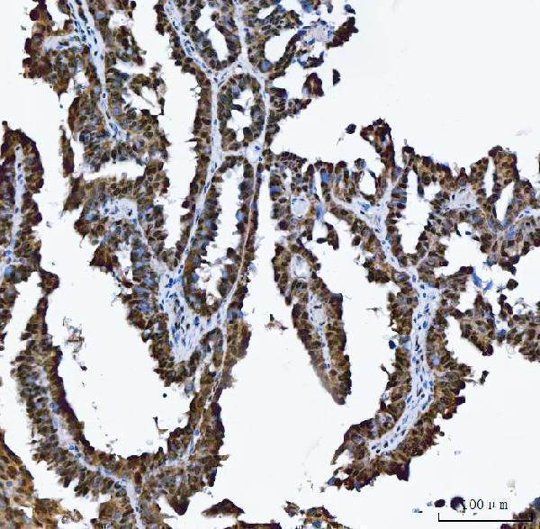 a09612 1 trmt10c primary antibodies ihc testing 6