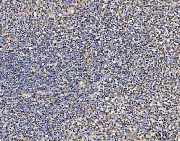 a09612 1 trmt10c primary antibodies ihc testing 7