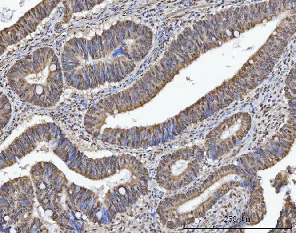 a09612 1 trmt10c primary antibodies ihc testing 8